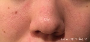 suicai 酵素洗顔18日目