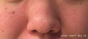 suicai 酵素洗顔19日目