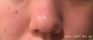 suisai酵素洗顔２３日目